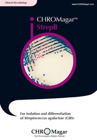 CHROMagar StrepB